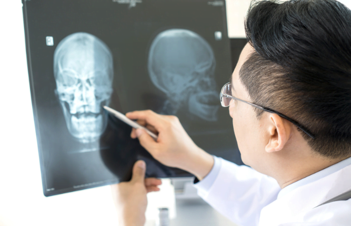   Digital Xray for Skull AP scans